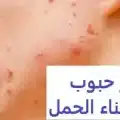 ظهور حبوب بالوجه أثناء الحمل