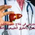 علاج دهون الكبد